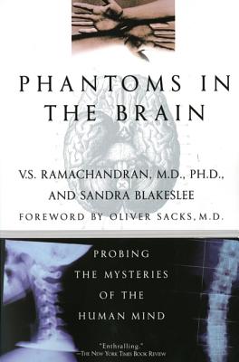 Phantoms in the Brain