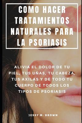 Como Hacer Tratamientos Naturales Para La Psoriasis: Alivia El Dolor de Tu Piel, Tus Uñas, Tu Cabeza, Tus Axilas Y de Todo Tu Cuerpo de Todos Los Tipo