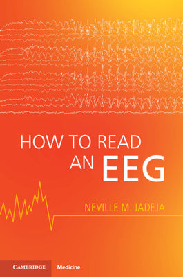 How to Read an EEG