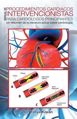 Manual de procedimientos cardiacos intervencionistas para cardiólogos principiantes: (un resumen de la literatura actual sobre cardiología)