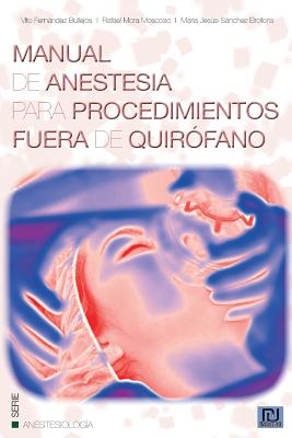 Manual de anestesia para procedimientos fuera de quirofano