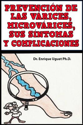 Prevencion de las Varices, Microvarices, Sus sintomas y complicaciones: (b & W)