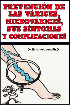 Prevencion de las Varices, Microvarices, sus sintomas y complicaciones: (Color)