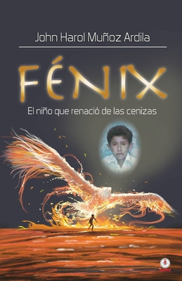 Fénix: El niño que renació de las cenizas