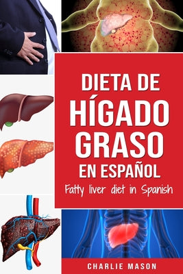 Dieta de hígado graso en español/Fatty liver diet in Spanish