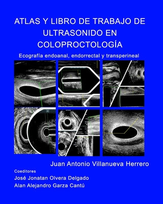 Atlas y Libro de Trabajo de Ultrasonido en Coloproctología: Ecografia endoanal, endorrectal y transperineal