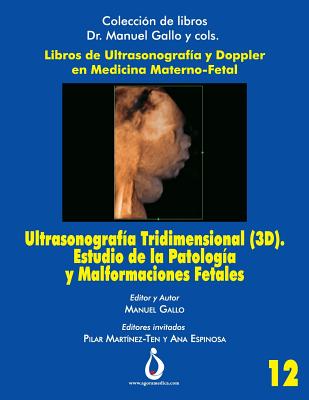 Ultrasonografía Tridimensional (3D). Estudio de la Patología y Malformaciones Fetales