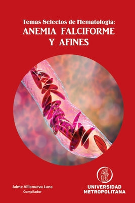 Temas Selectos de Hematología: Anemia Falciforme Y Afines