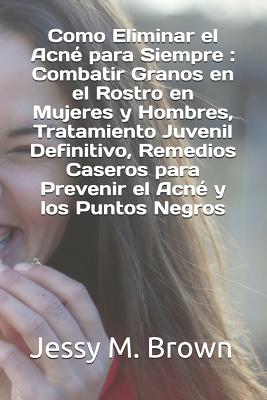 Como Eliminar el Acné para Siempre: Combatir Granos en el Rostro en Mujeres y Hombres, Tratamiento Juvenil Definitivo, Remedios Caseros para Prevenir