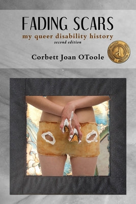 Fading Scars: My Queer Disability History, 2nd Edition