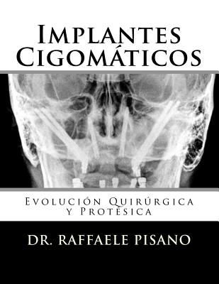 Implantes Cigomáticos: Evolución Quirúrgica y Protésica