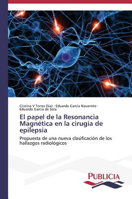 El papel de la Resonancia Magnética en la cirugía de epilepsia