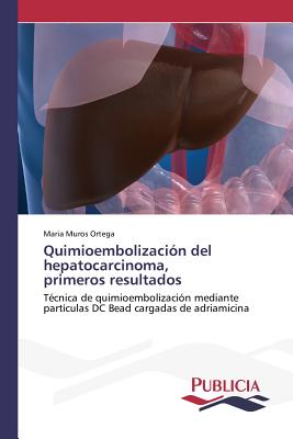 Quimioembolización del hepatocarcinoma, primeros resultados