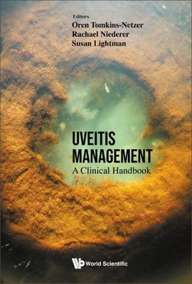 Uveitis Management: A Clinical Handbook